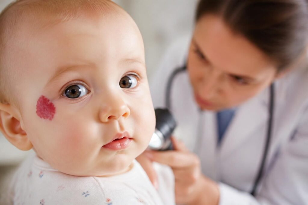 découvrez quand il est essentiel de consulter un spécialiste pour un angiome chez le bébé afin d'assurer une prise en charge rapide et adaptée.