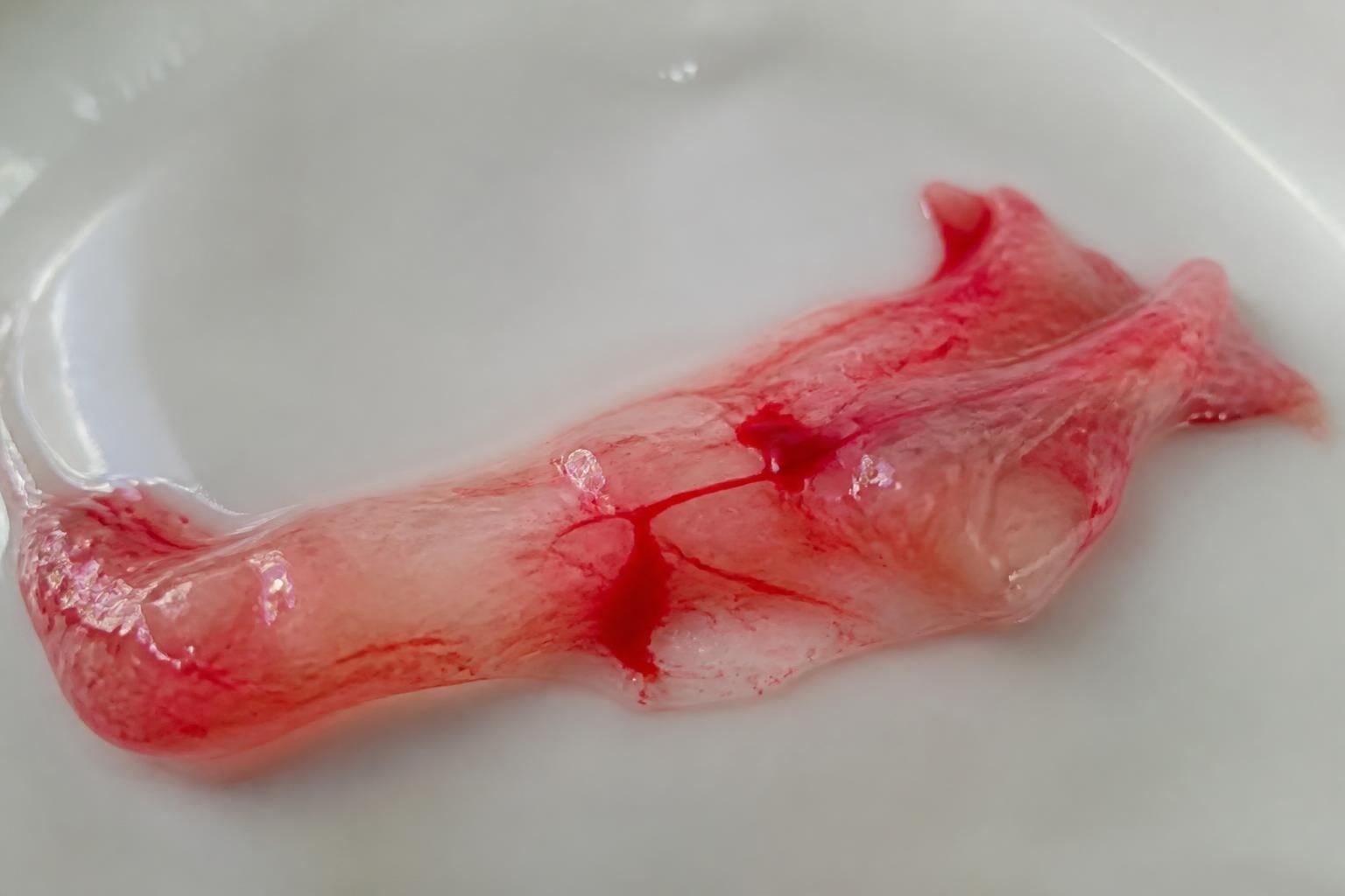 découvrez à quoi ressemble réellement un bouchon muqueux avec du sang, ses causes et ce que cela signifie pendant la grossesse.
